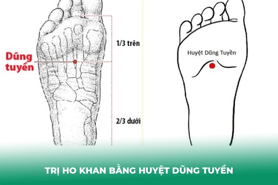 Trị ho khan bằng huyệt Dũng Tuyền