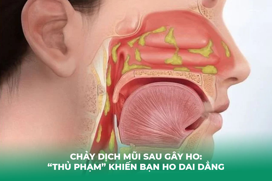 Chảy Dịch Mũi Sau Gây Ho: “Thủ Phạm” Khiến Bạn Ho Dai Dẳng