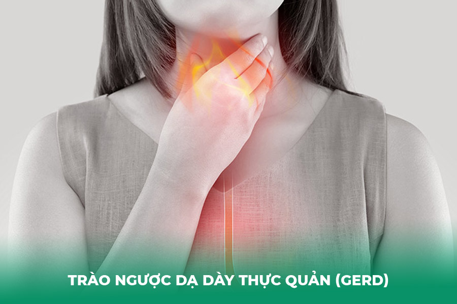 Trào Ngược Dạ Dày Thực Quản (GERD)
