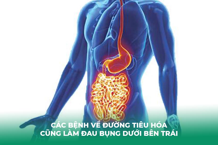 Các bệnh về đường tiêu hóa cũng làm đau bụng dưới bên trái