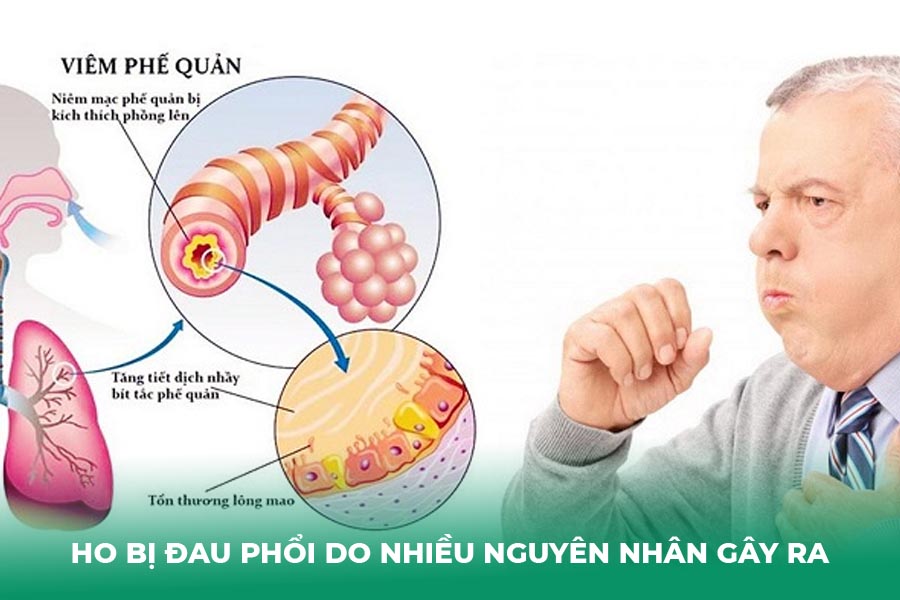 Ho bị đau phổi do nhiều nguyên nhân gây ra