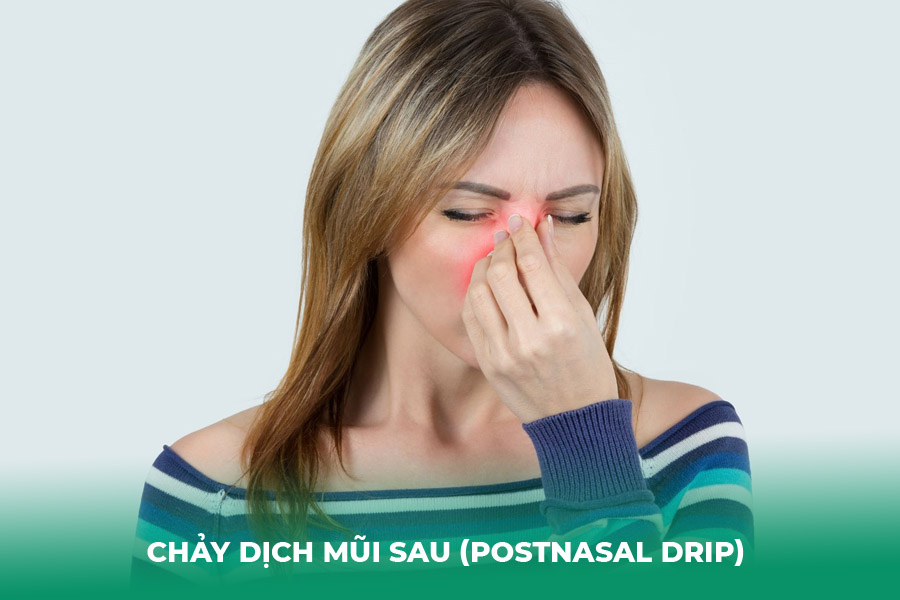 Chảy dịch mũi sau (Postnasal Drip)&nbsp;