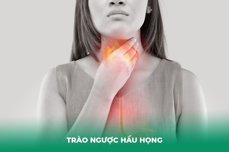 Trào ngược hầu họng