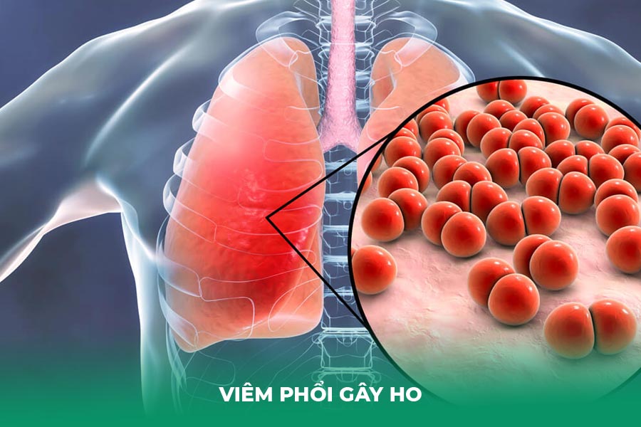 Viêm phổi gây ho