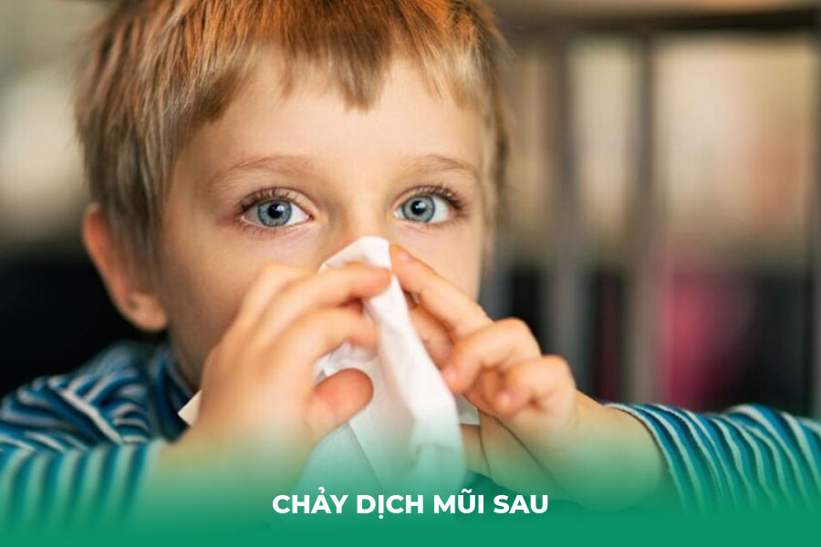 Chảy Dịch Mũi Sau