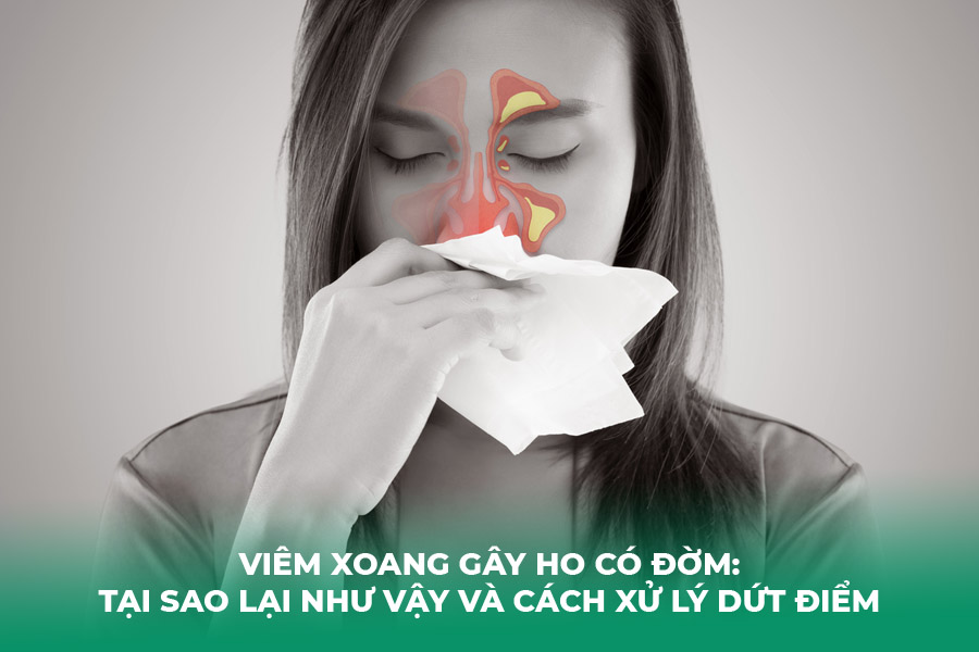 Viêm Xoang Gây Ho Có Đờm: Tại Sao Lại Như Vậy Và Cách Xử Lý Dứt Điểm