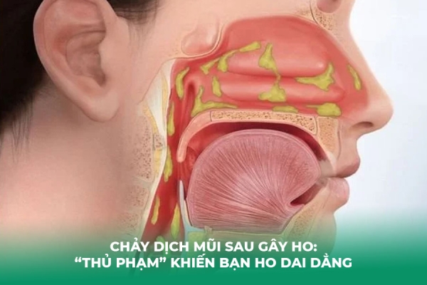 Chảy Dịch Mũi Sau Gây Ho: “Thủ Phạm” Khiến Bạn Ho Dai Dẳng