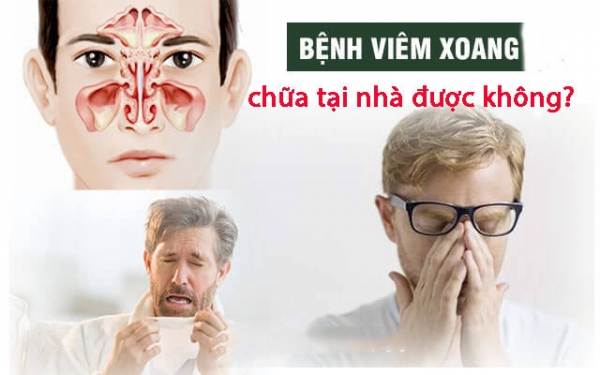 Chữa viêm xoang mũi tại nhà nên hay không