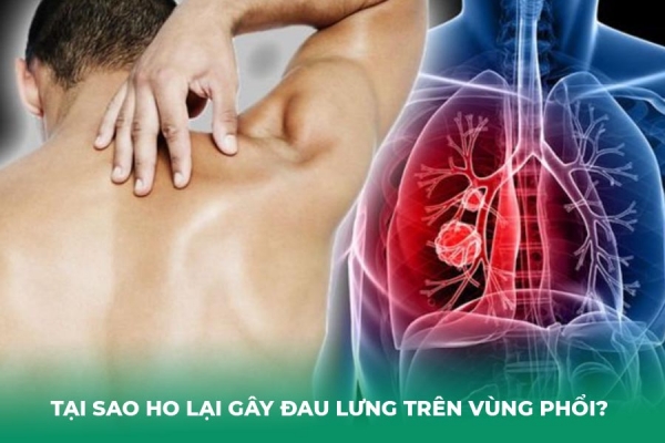 Giải Đáp: Ho Đau Lưng Trên Vùng Phổi Cảnh Báo Bệnh Gì
