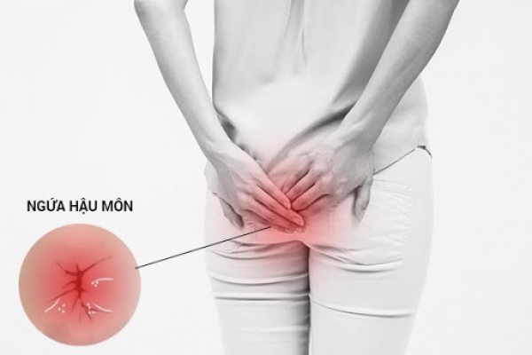 Hậu môn bị ngứa có nguy hiểm không