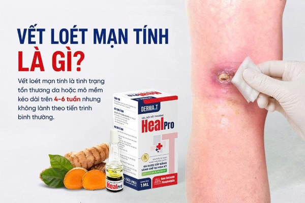 Loét mạn tính: Nguyên nhân và cách chăm sóc đúng
