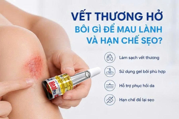 Vết thương hở bôi gì để mau lành và hạn chế sẹo Gợi ý cách chăm sóc đúng cách