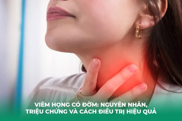 Viêm Họng Có Đờm: Nguyên Nhân, Triệu Chứng và Cách Điều Trị Hiệu Quả